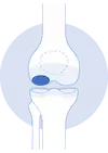 Cartilage Regeneration Image Rescaled