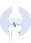Cruciate Ligament Image