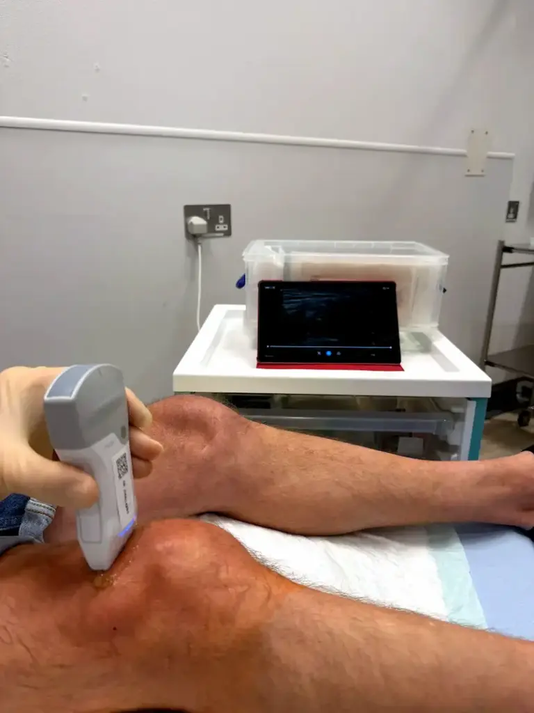 Kneeultrasoundarthrosamidinjection Enhanced (1)