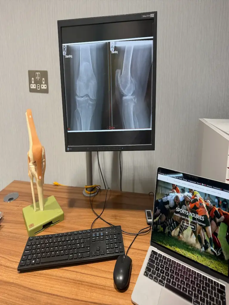 Knee X Ray And Consultation Table